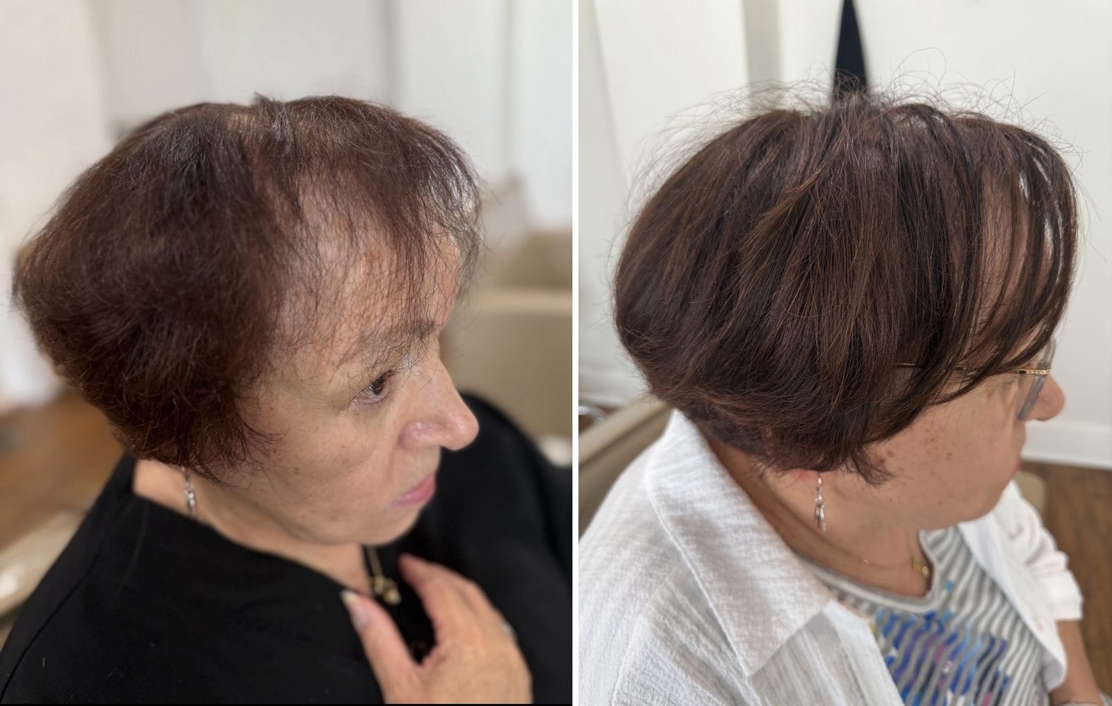 K-tip extension before and after, added length and volume