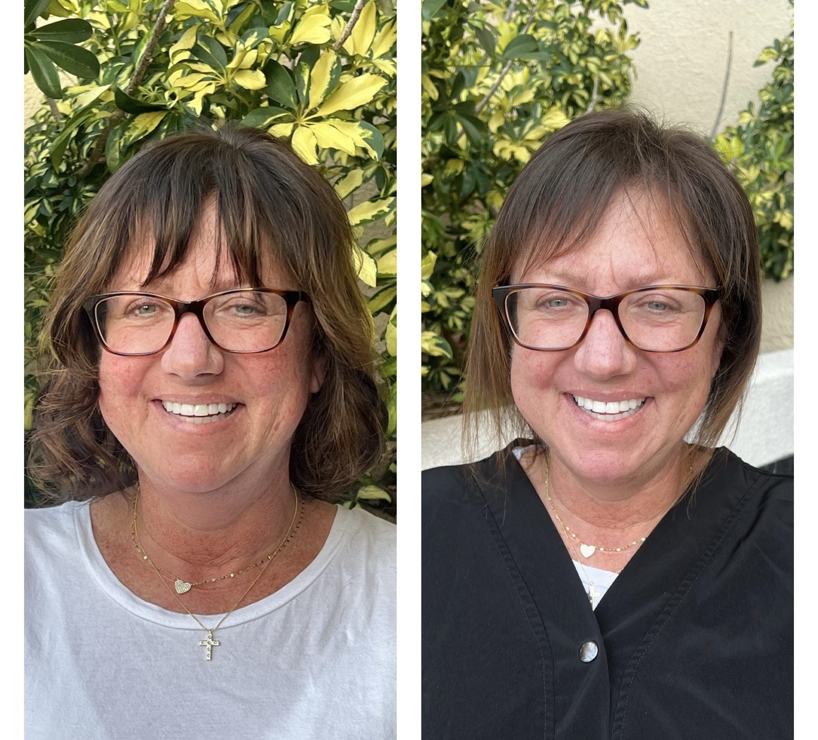 K-tip extension transformation, natural color match