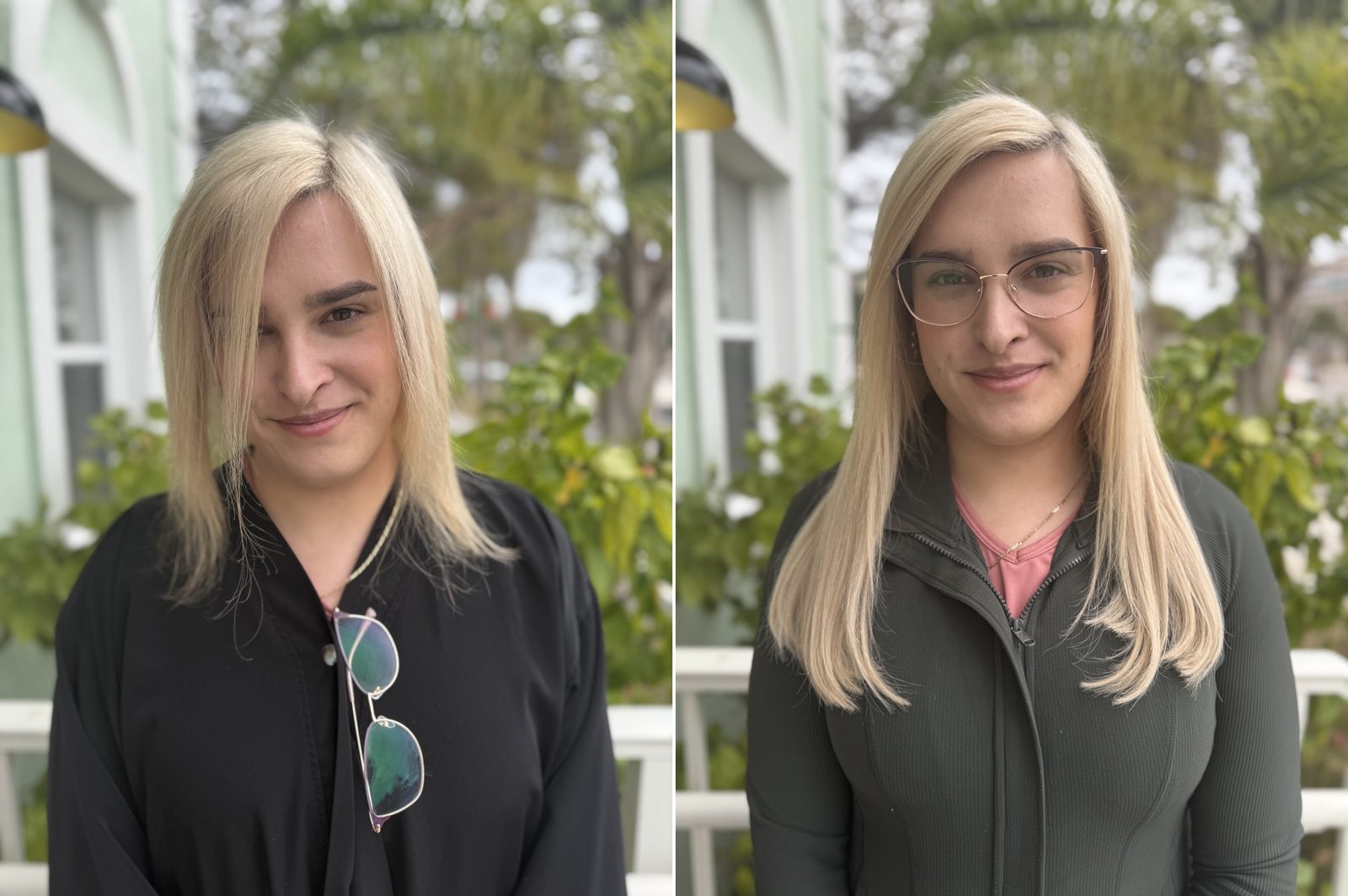 K-tip extension before and after, added length and volume